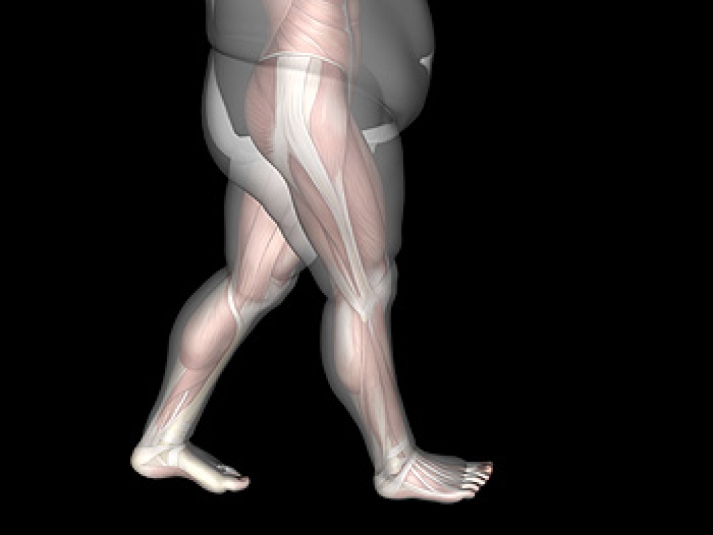 How Obesity May Contribute to Foot Pain