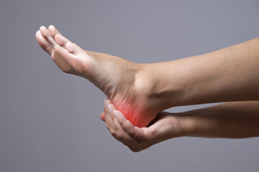 Inferior Calcaneal Bursitis and Persistent Heel Pain