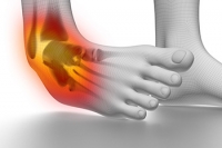 Proper Care For Ankle Sprains